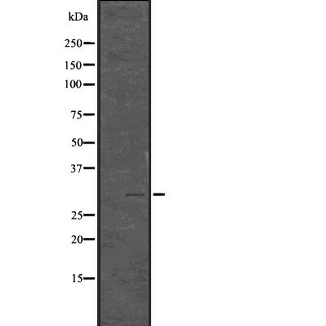 Phospho-CDK1/CDK2 (Thr14) Antibody in Western Blot (WB)