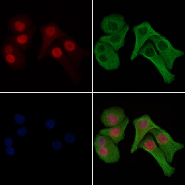 Phospho-Histone H1.3 (Thr18) Antibody in Immunocytochemistry (ICC/IF)
