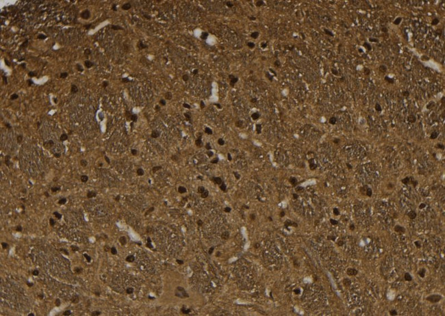 Phospho-HSF1 (Ser326) Antibody in Immunohistochemistry (Paraffin) (IHC (P))