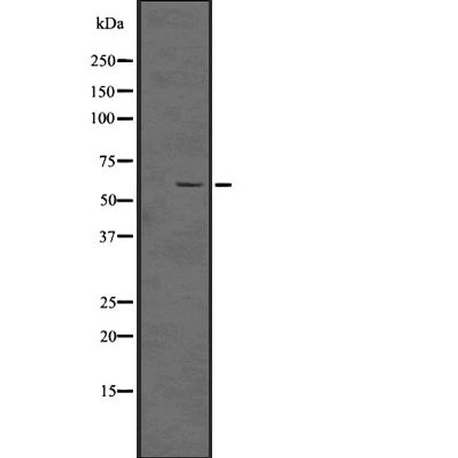 Phospho-SMAD5 (Ser463, Ser465) Antibody in Western Blot (WB)