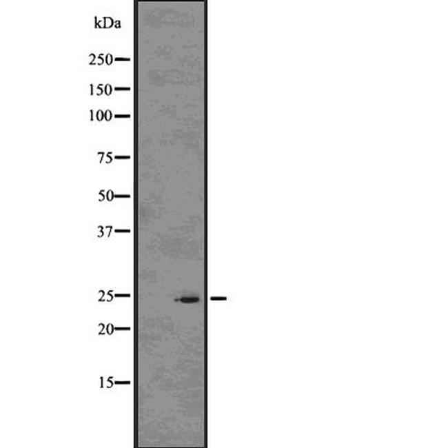 Rho Pan Antibody in Western Blot (WB)