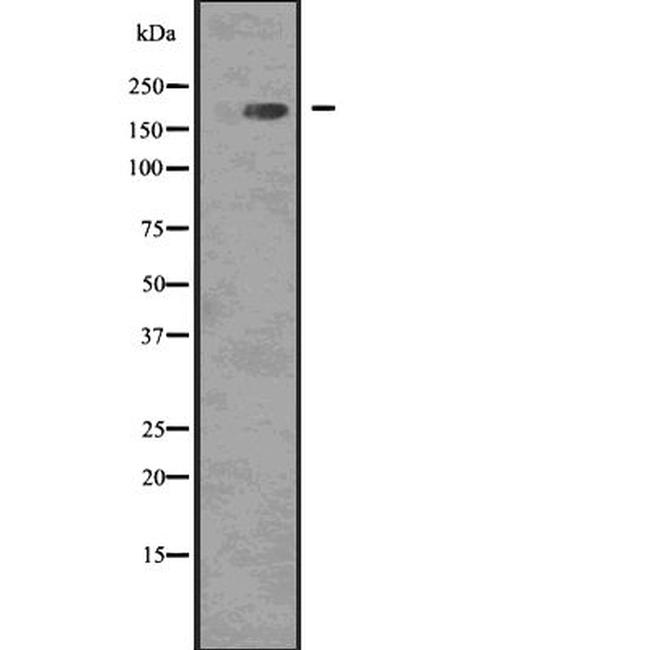 Phospho-EGFR (Tyr1092) Antibody in Western Blot (WB)