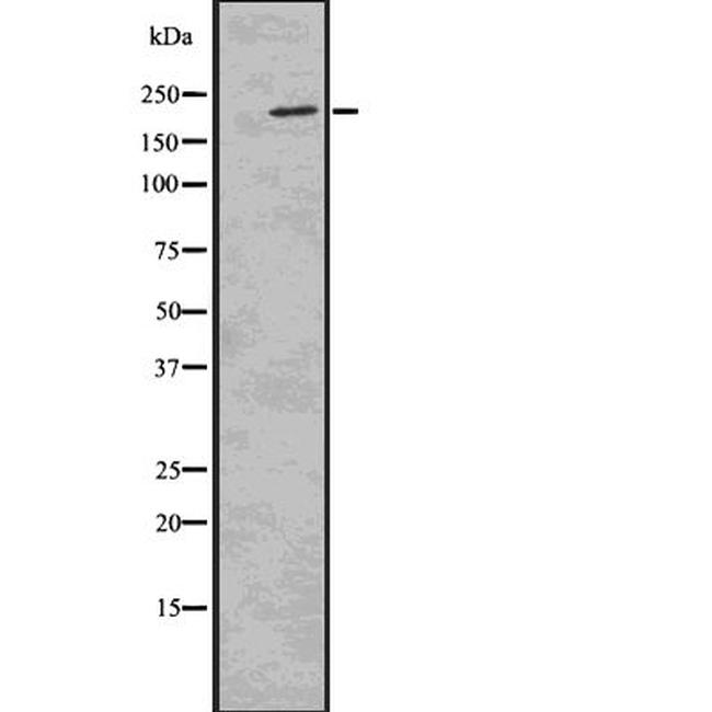 Phospho-53BP1 (Ser25, Ser29) Antibody in Western Blot (WB)