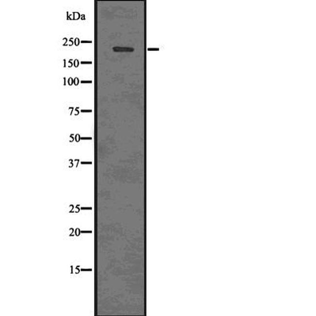 Phospho-53BP1 (Ser1778) Antibody in Western Blot (WB)
