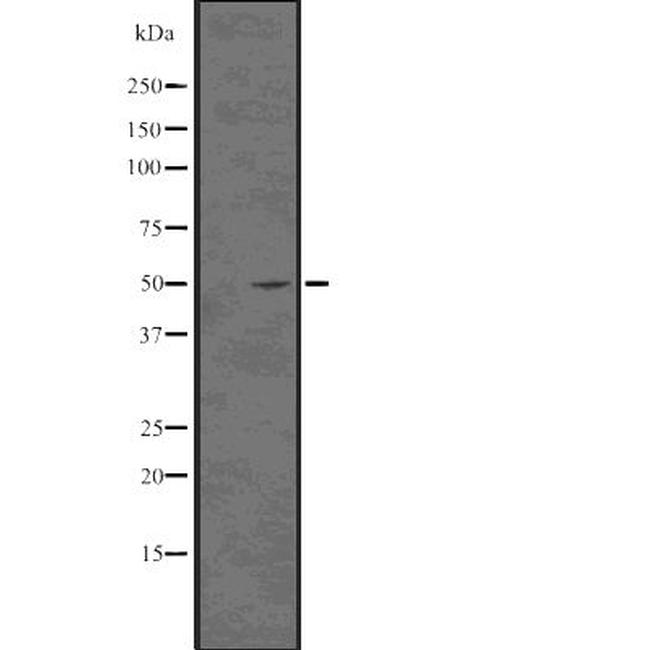 Acetyl-Tubulin alpha-1B (Lys40) Antibody in Western Blot (WB)
