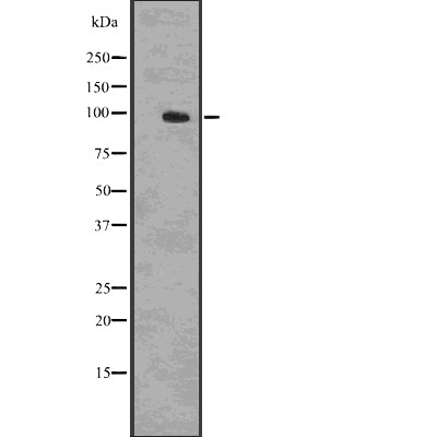 Phospho-beta Catenin (Ser33, Ser37, Thr41) Antibody in Western Blot (WB)