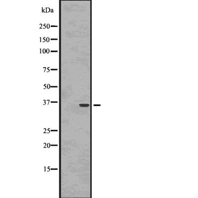 Nkx6.3 Antibody in Western Blot (WB)