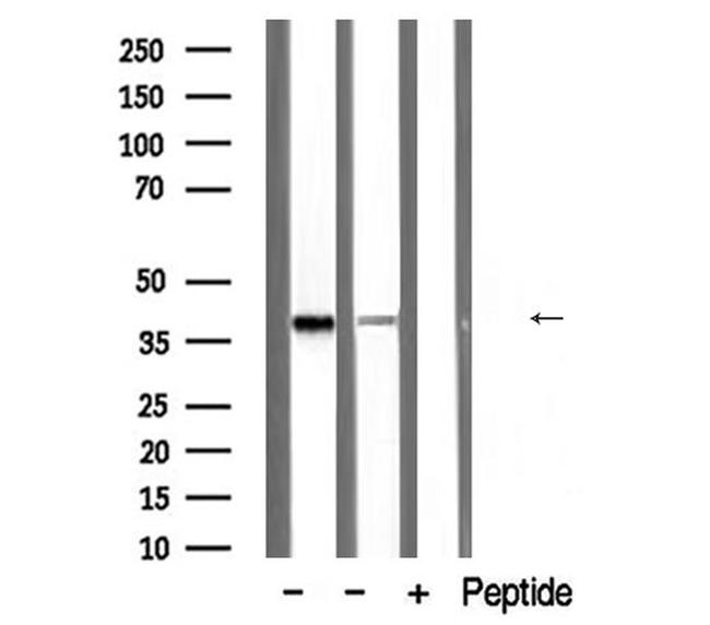 PDLIM1 Antibody in Western Blot (WB)