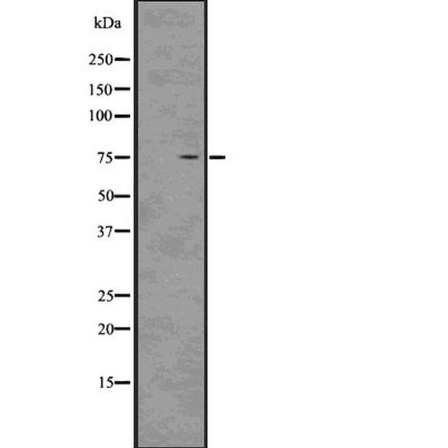 MID1 Antibody in Western Blot (WB)