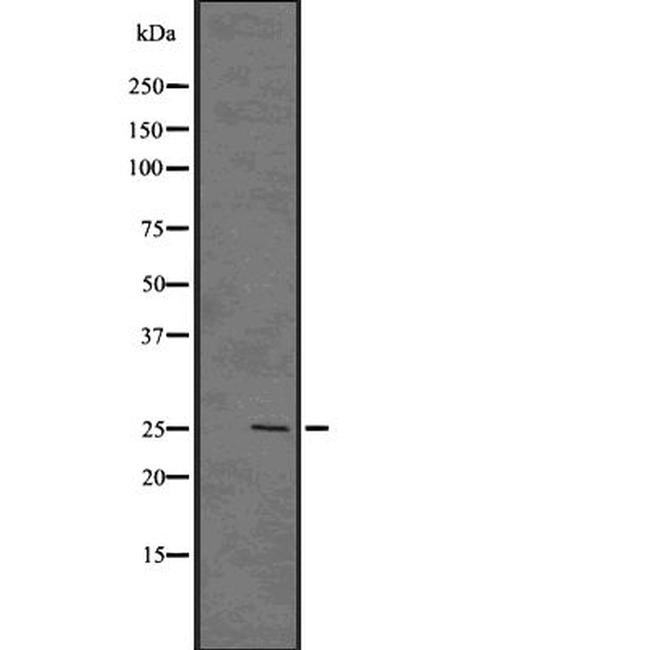 GSC2 Antibody in Western Blot (WB)