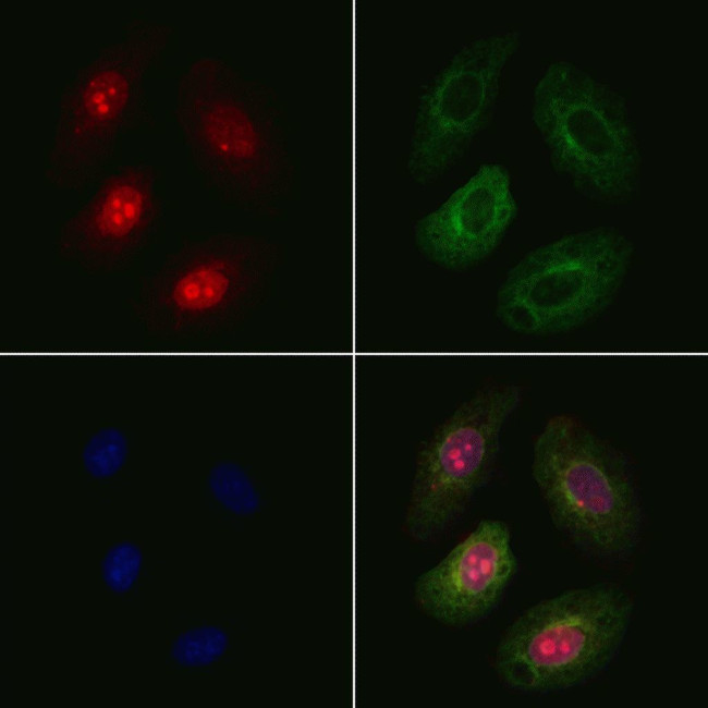 PHF1 Antibody in Immunocytochemistry (ICC/IF)