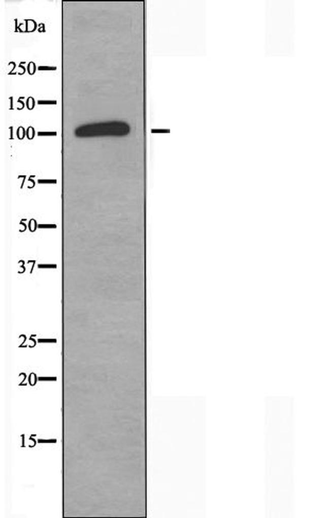 ST18 Antibody in Western Blot (WB)