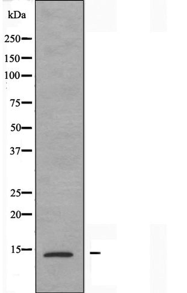 PFDN1 Antibody in Western Blot (WB)