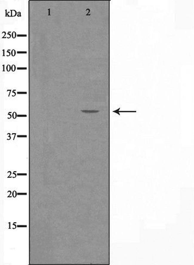 ZNF682 Antibody in Western Blot (WB)