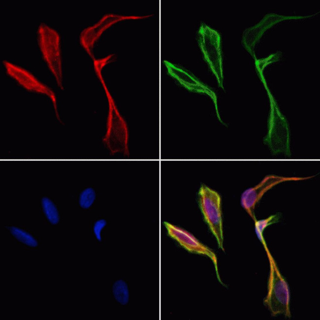 PFKFB1 Antibody in Immunocytochemistry (ICC/IF)