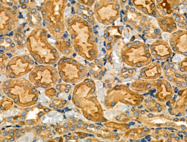 PKA gamma Antibody in Immunohistochemistry (Paraffin) (IHC (P))