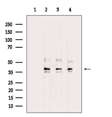GTF2E2 Antibody in Western Blot (WB)