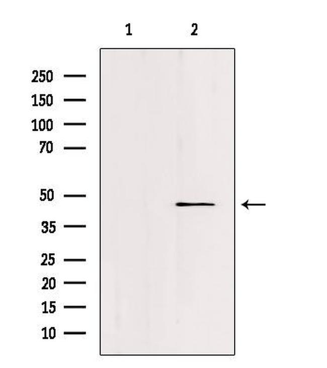 FOXN2 Antibody in Western Blot (WB)