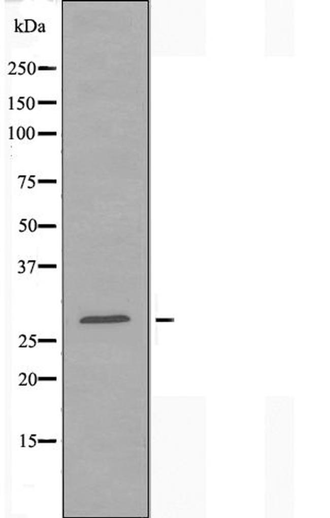 HOXD12 Antibody in Western Blot (WB)