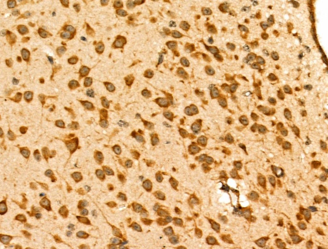 GRK6 Antibody in Immunohistochemistry (Paraffin) (IHC (P))