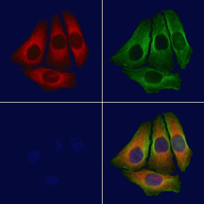BAP31 Antibody in Immunocytochemistry (ICC/IF)