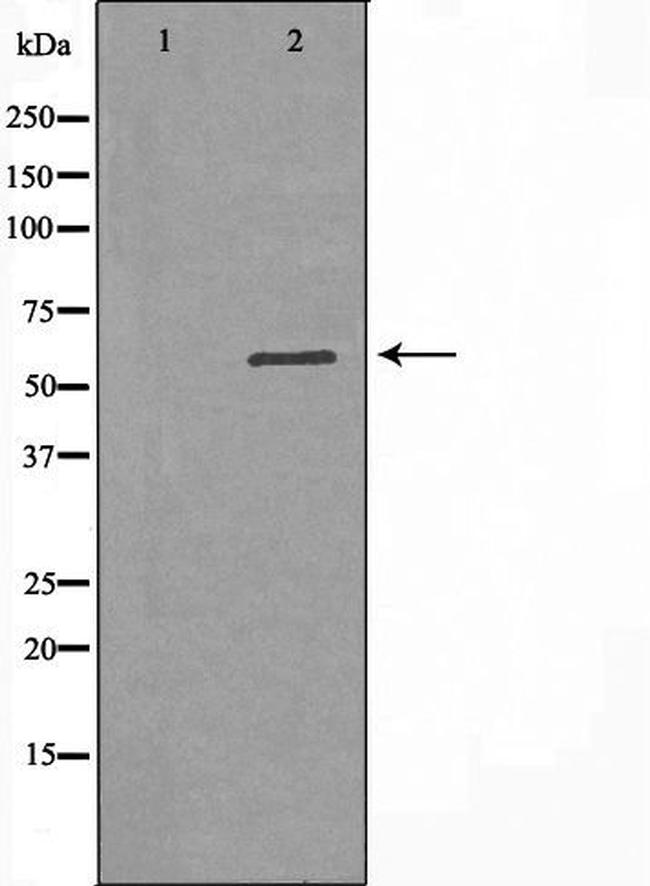 DGKE Antibody in Western Blot (WB)