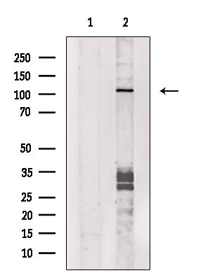 DGKQ Antibody in Western Blot (WB)
