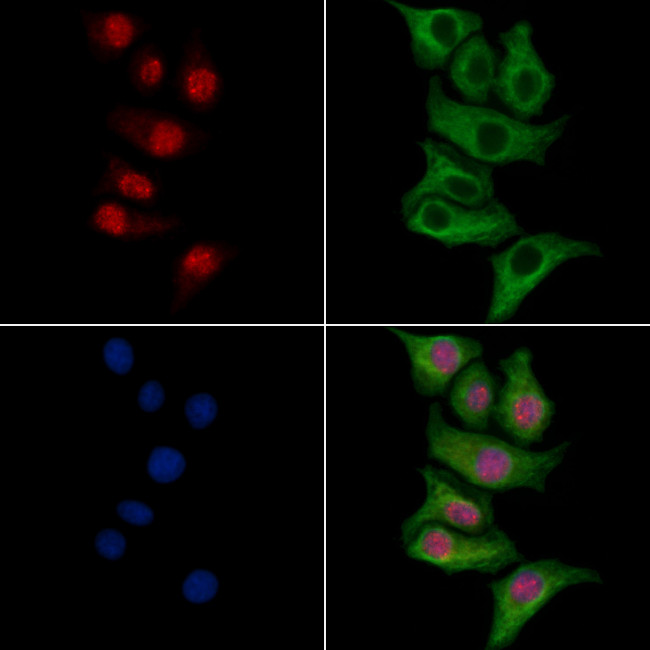 ELL Antibody in Immunocytochemistry (ICC/IF)