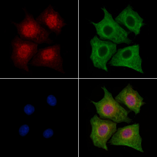 LMO4 Antibody in Immunocytochemistry (ICC/IF)