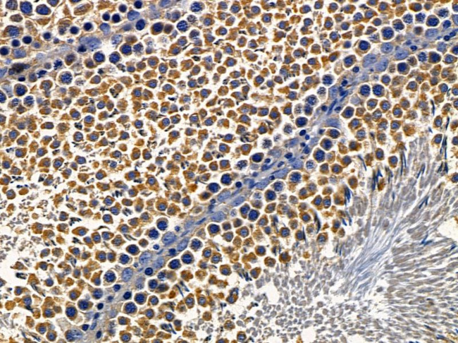 ST5 Antibody in Immunohistochemistry (Paraffin) (IHC (P))