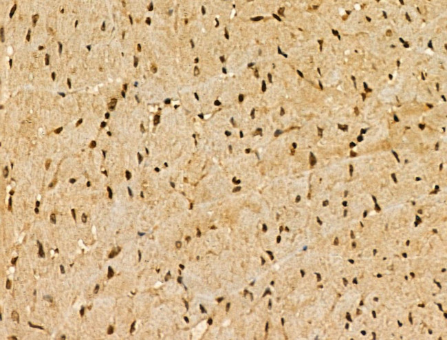 CDKL1 Antibody in Immunohistochemistry (Paraffin) (IHC (P))