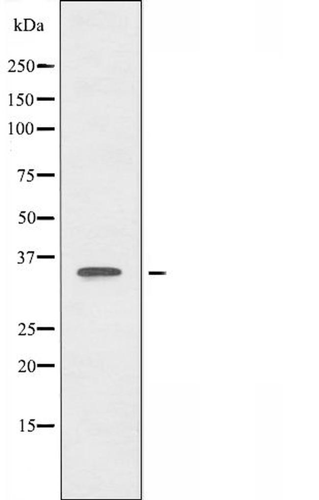 FOXL1 Antibody in Western Blot (WB)