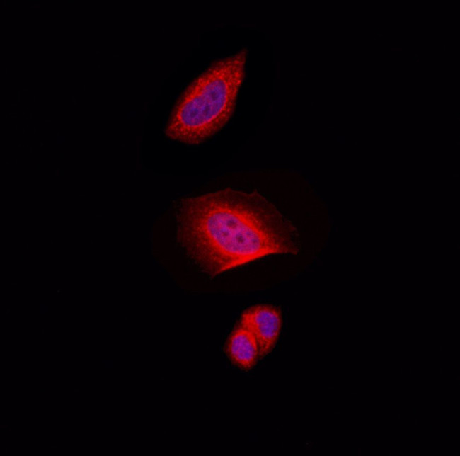 CAF1 p60 Antibody in Immunocytochemistry (ICC/IF)