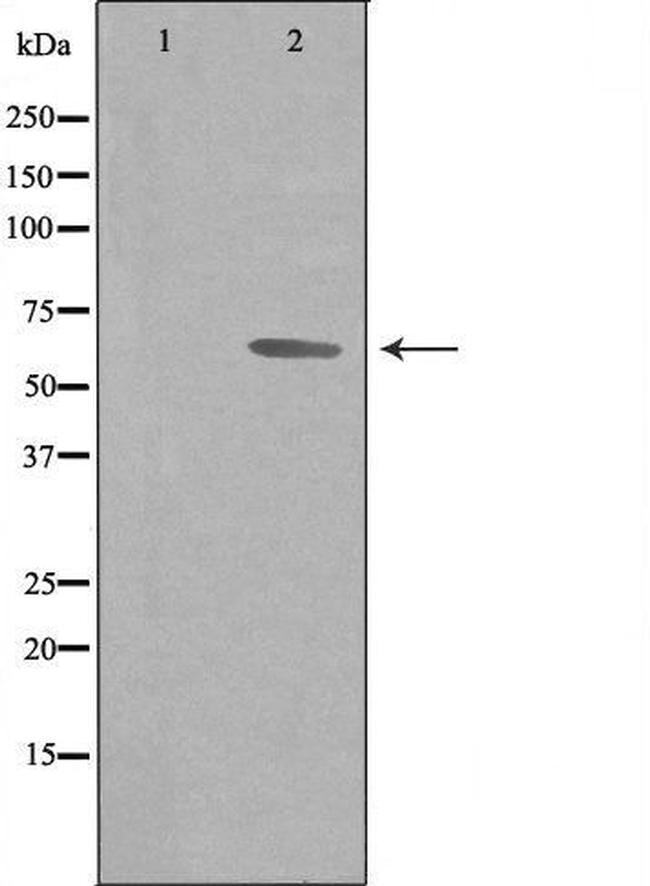 GTF2H2 Antibody in Western Blot (WB)