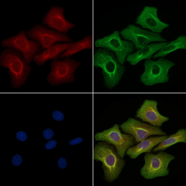 MELK Antibody in Immunocytochemistry (ICC/IF)