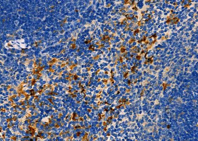 FASTKD3 Antibody in Immunohistochemistry (Paraffin) (IHC (P))