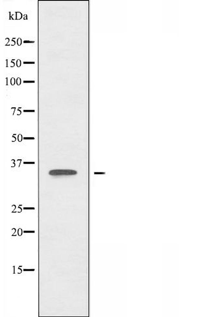 CARP Antibody in Western Blot (WB)
