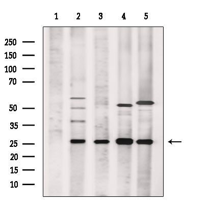 TSN Antibody in Western Blot (WB)