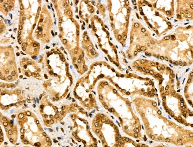 ASC1 Antibody in Immunohistochemistry (Paraffin) (IHC (P))