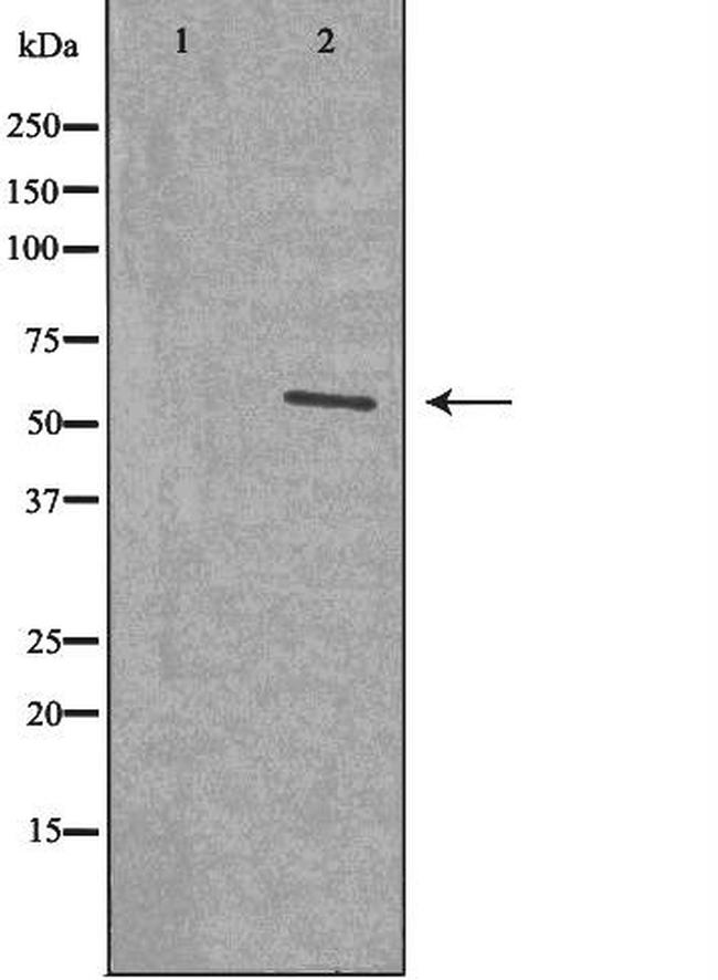 NAB2 Antibody in Western Blot (WB)