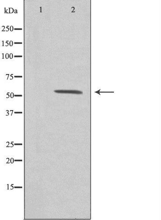 ZNF187 Antibody in Western Blot (WB)