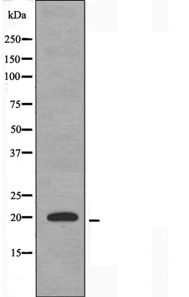 TNFAIP8L2 Antibody in Western Blot (WB)