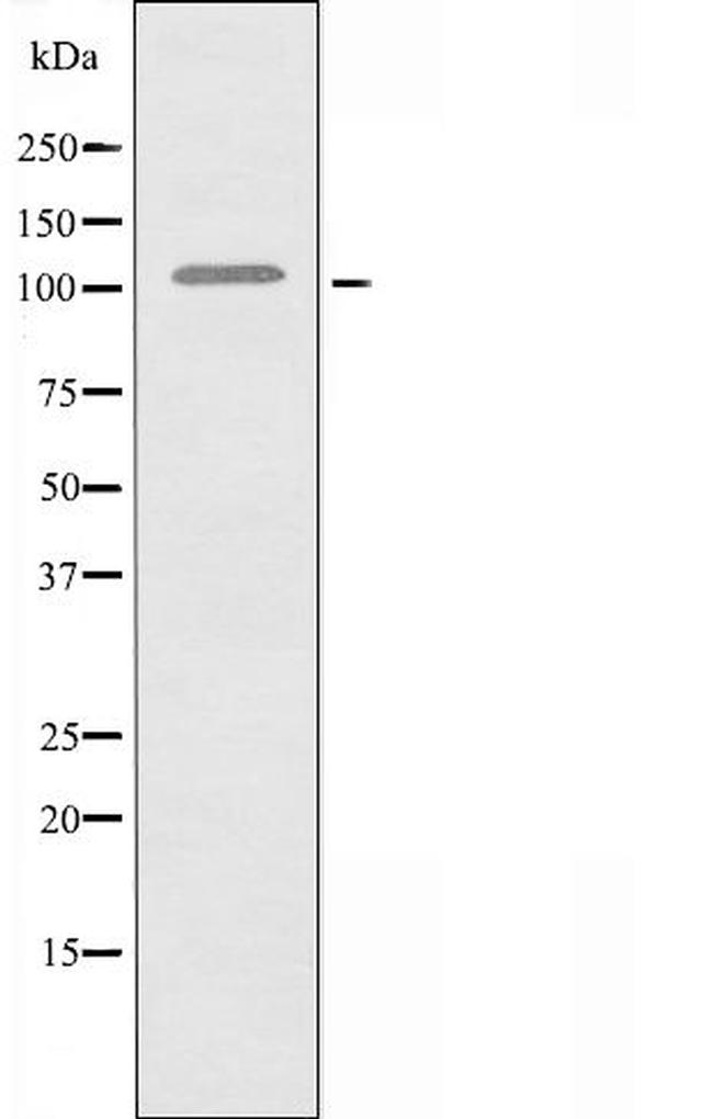 KSR2 Antibody in Western Blot (WB)