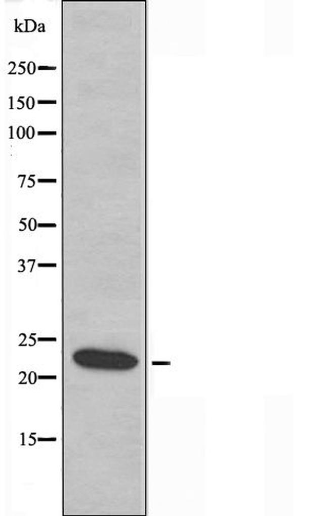 AKAP14 Antibody in Western Blot (WB)