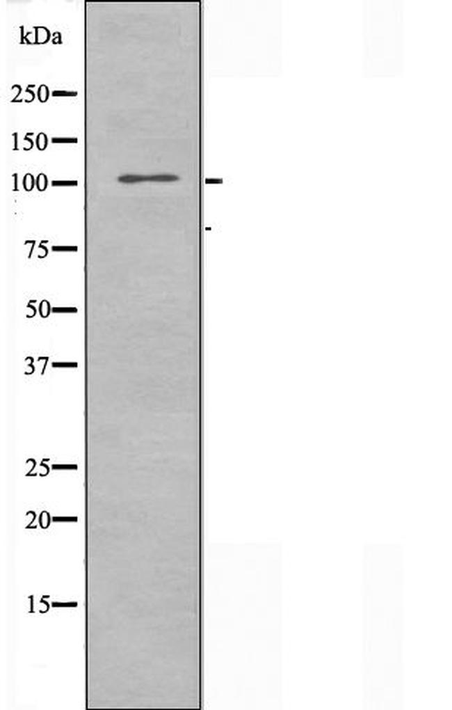 FUK Antibody in Western Blot (WB)