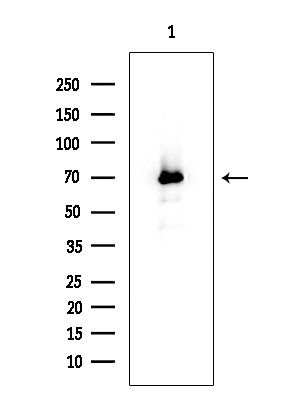 CAMKV Antibody in Western Blot (WB)