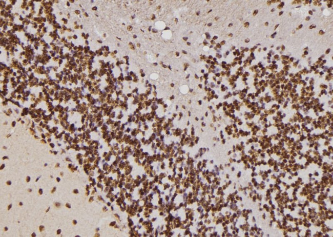 HIPK4 Antibody in Immunohistochemistry (Paraffin) (IHC (P))