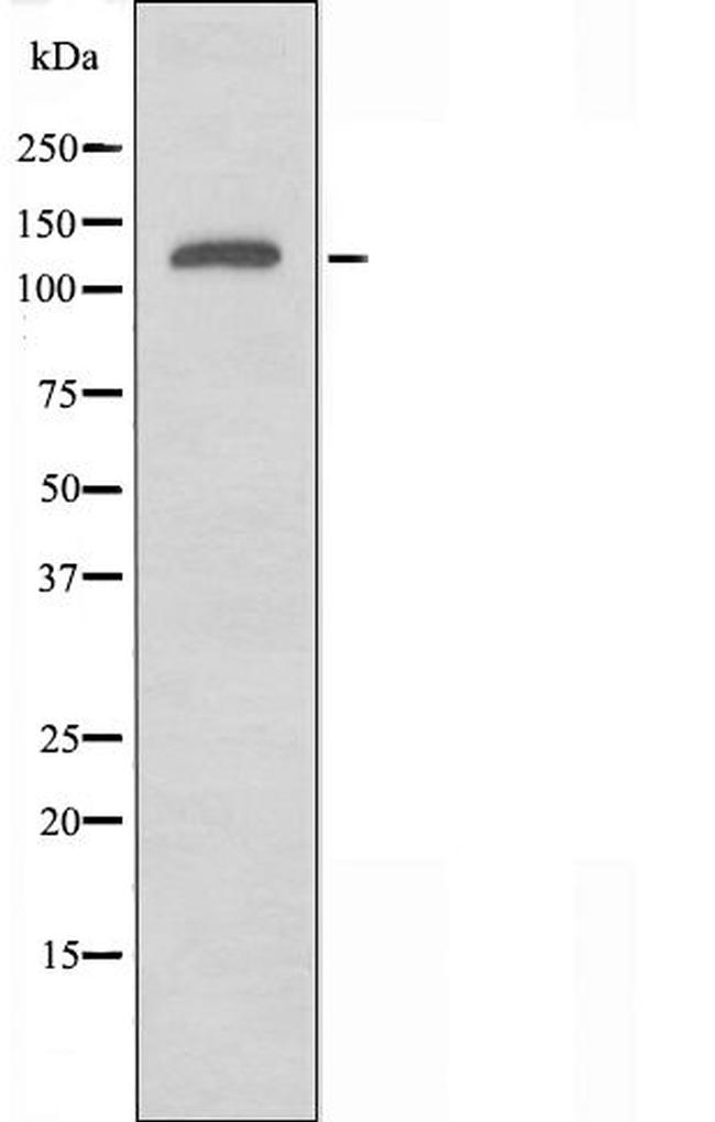 RGAG1 Antibody in Western Blot (WB)