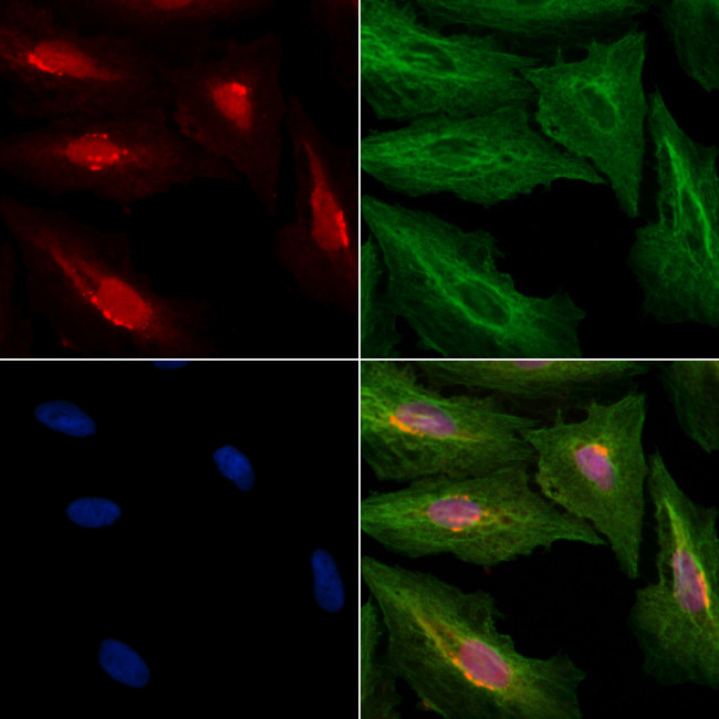 PPHLN1 Antibody in Immunocytochemistry (ICC/IF)