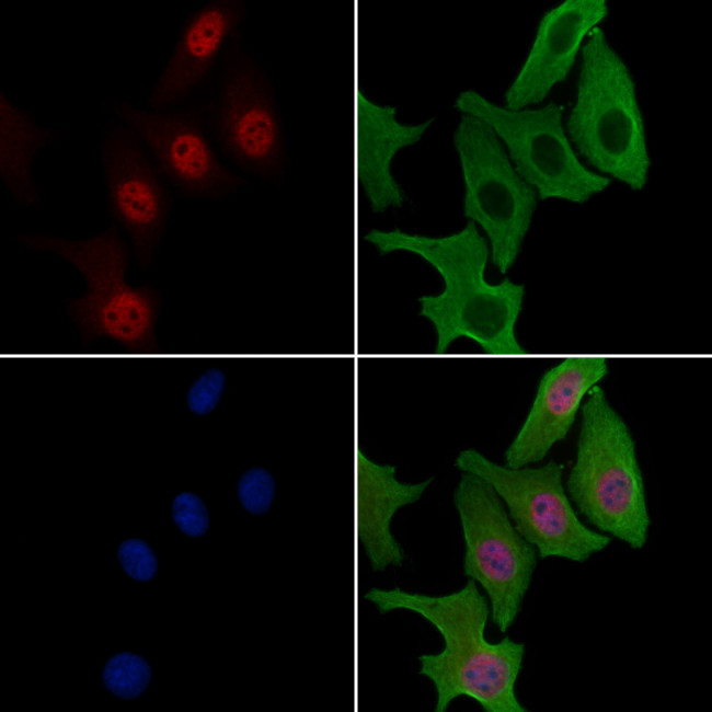 ZNF397 Antibody in Immunocytochemistry (ICC/IF)